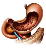Stomach Stock Image